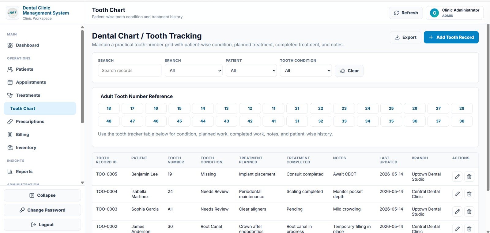 Dental Clinic Management System tooth chart page